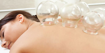 Cupping